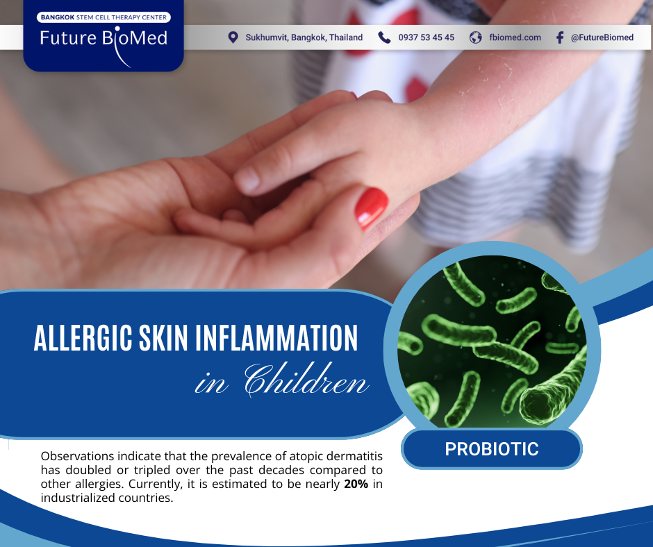 Allergic Skin Inflamation