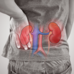 Treatment of kidney failure with umbilical cord stem cells