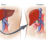 MSC-CM and its potential in liver diseases treatments