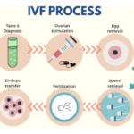 NK Cell Therapy in Assisted Reproduction (IVF)